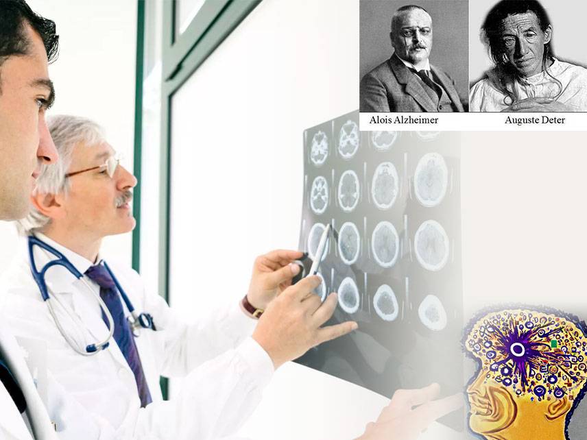 What is Alzheimer's disease: symptoms, diagnosis, treatment.